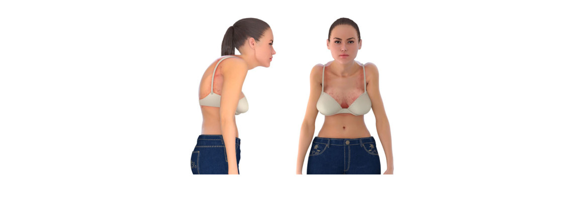 Why is wearing the wrong bra size bad?