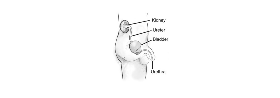 Penile Clamp for Male Urinary Incontinence